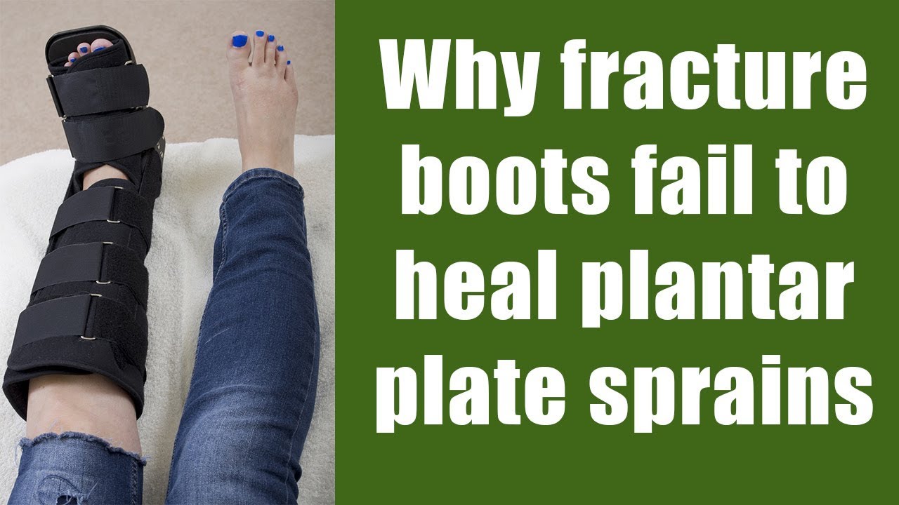Why fracture boots fail to heal plantar plate sprains in runners