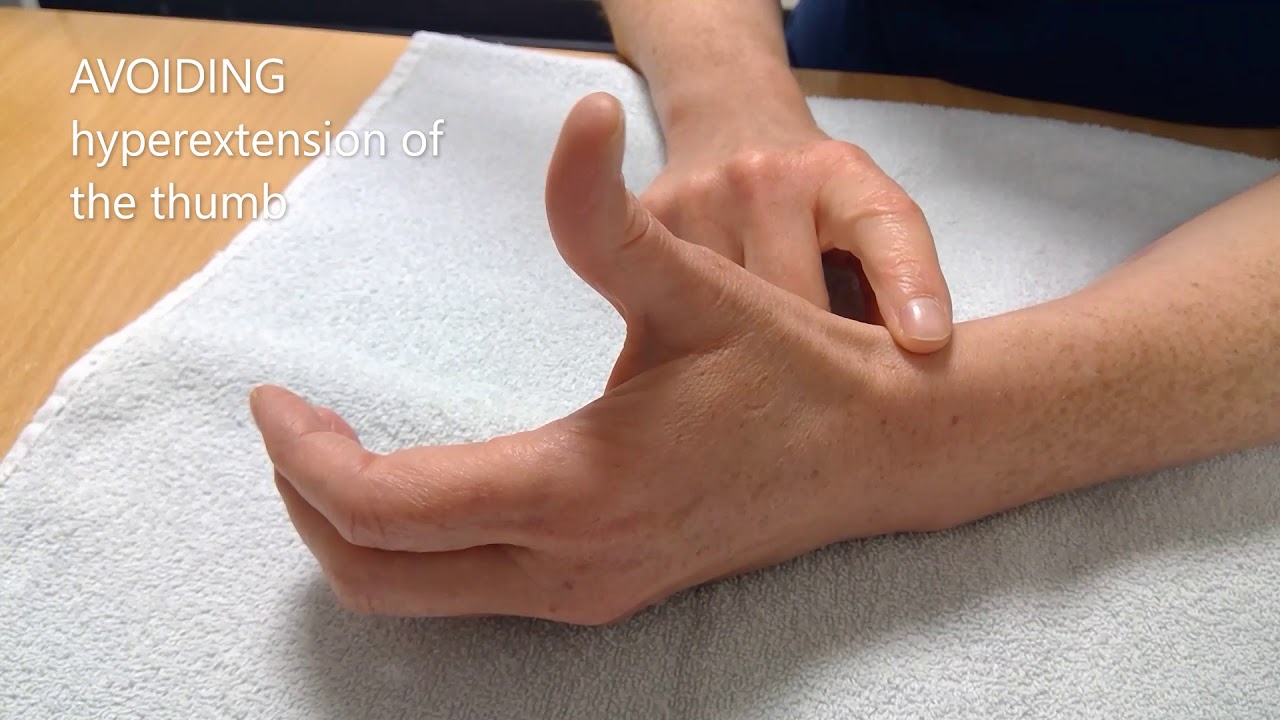 Osteoarthritis of carpometacarpal Thumb joint