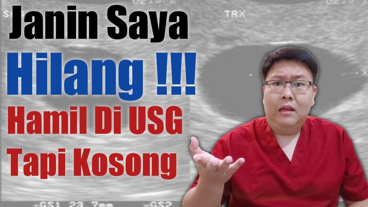 HAMIL TAPI DI USG BELUM KELIHATAN - TANYAKAN DOKTER