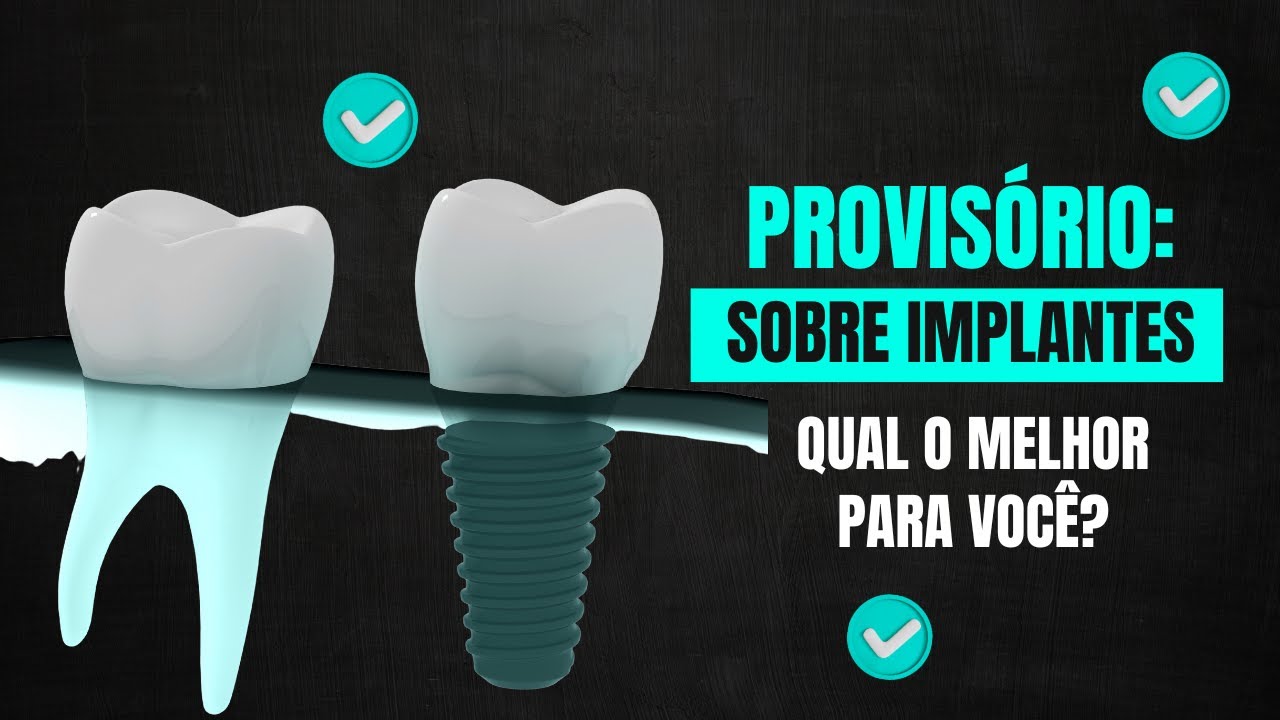 PROVISÓRIO SOBRE IMPLANTE - QUAL É O MELHOR PARA VOCÊ ?