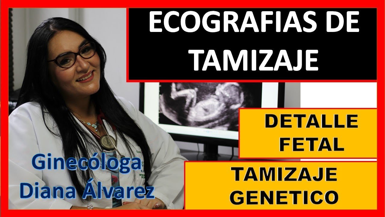 ECOGRAFIA DE TAMIZAJE GENETICO Y DETALLE FETAL, POR GINECOLOGA DIANA ALVAREZ