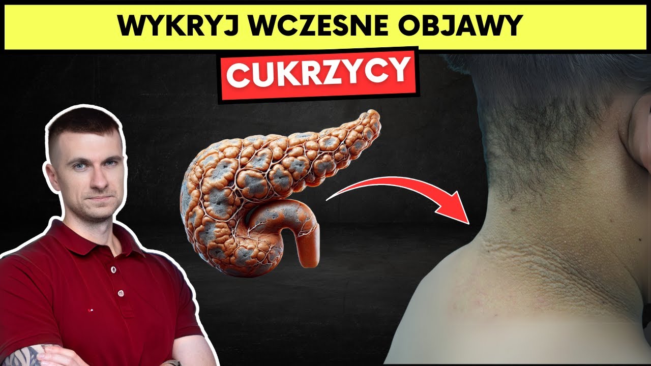 Cukrzyca zaczyna się od tych objawów – sprawdź, czy je masz!