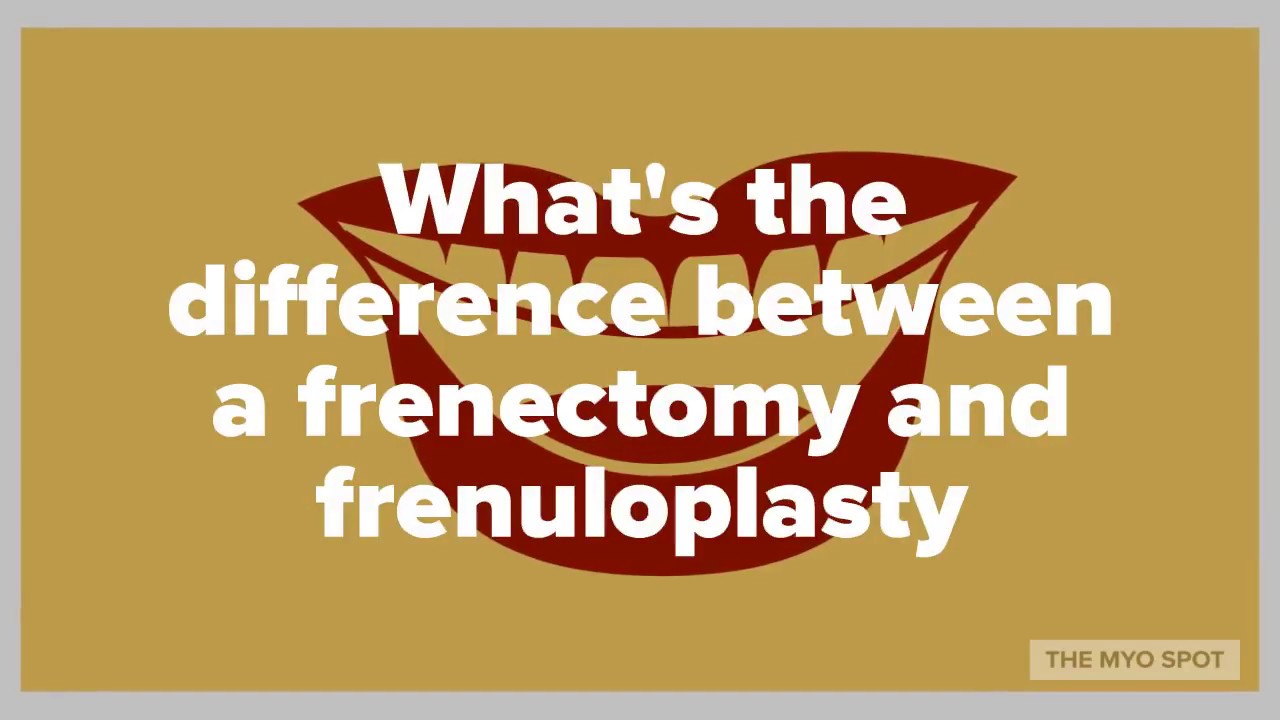 Frenectomy vs Frenuloplasty: What's the difference? Sixty Second Saturday