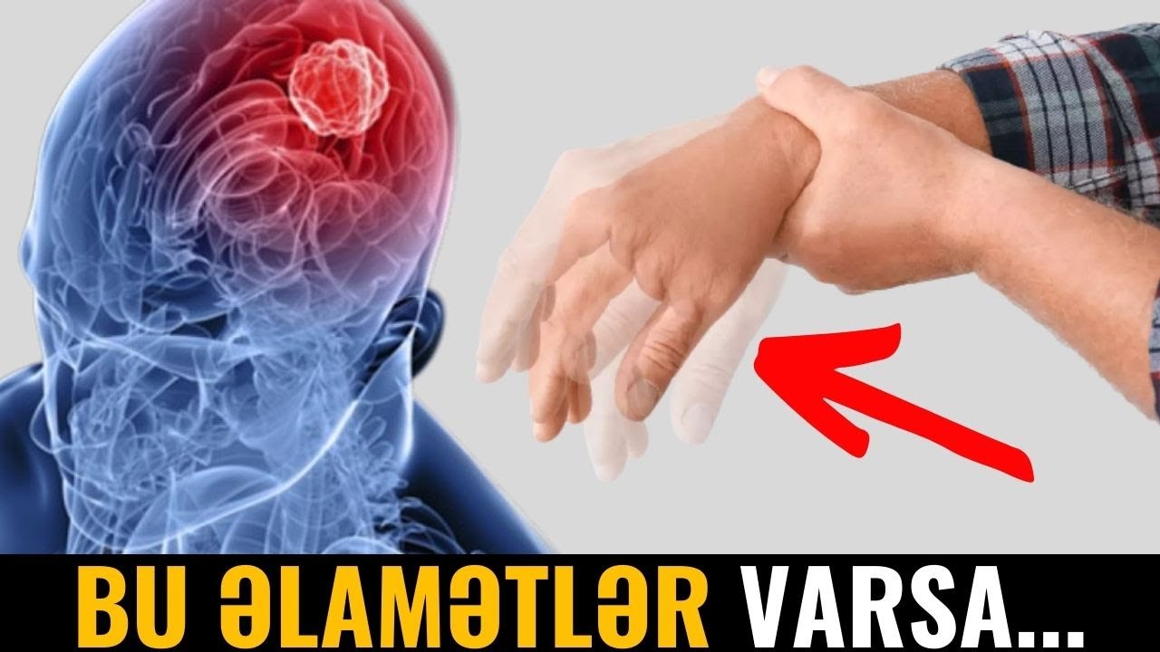 PARKİNSON XƏSTƏLİYİ - Genetik Xəstəlikdir?