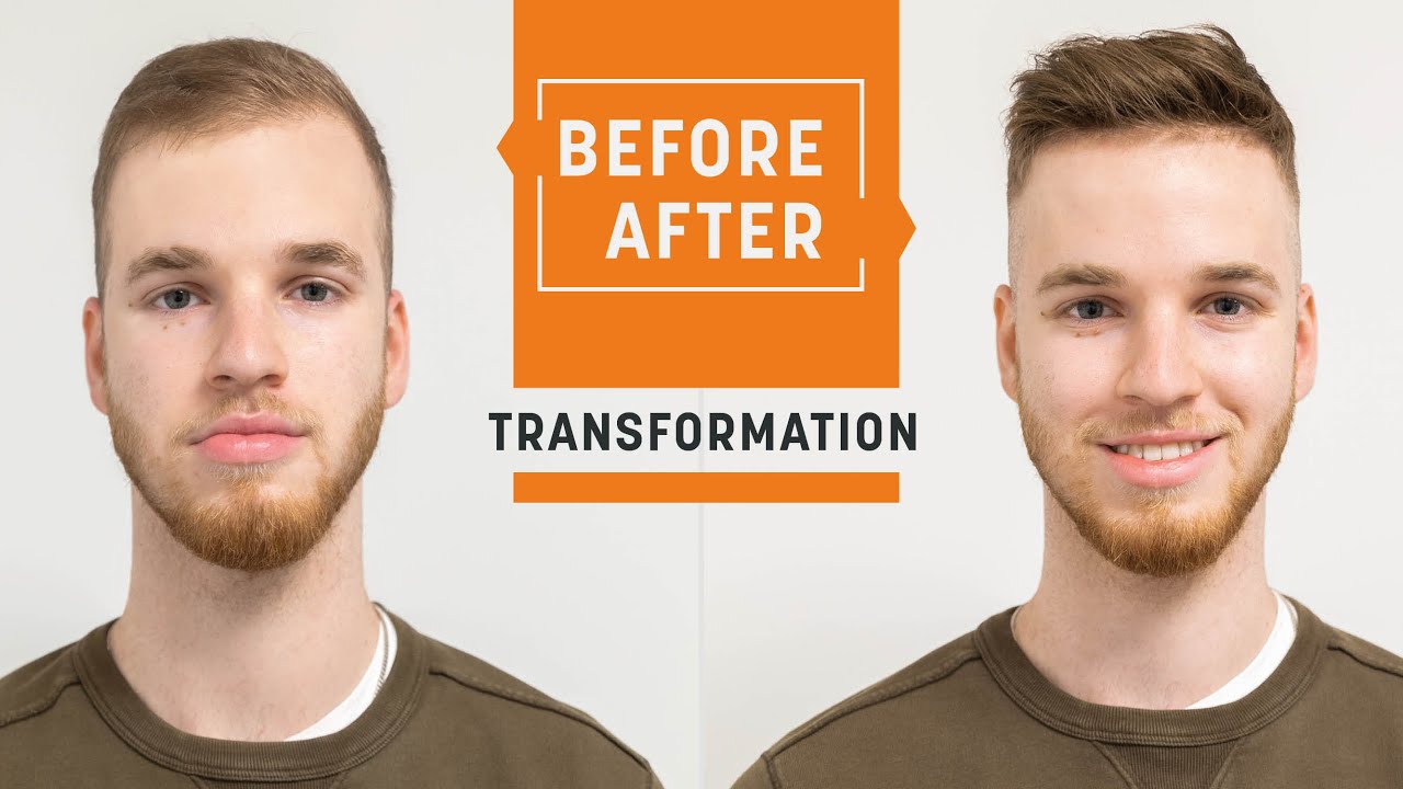 Hair replacement instead of hair transplant | hair transformation | Hairsystems Heydecke