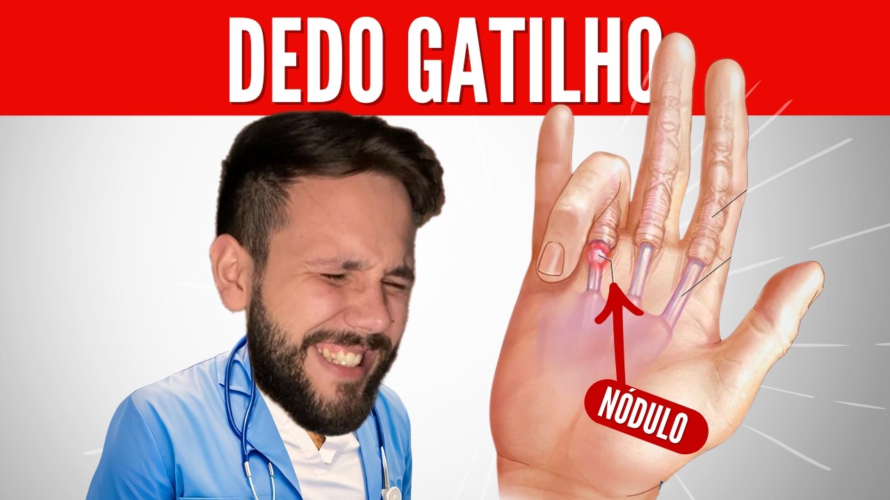 Como tratar DEDO GATILHO em casa com apenas 3 exercícios simples