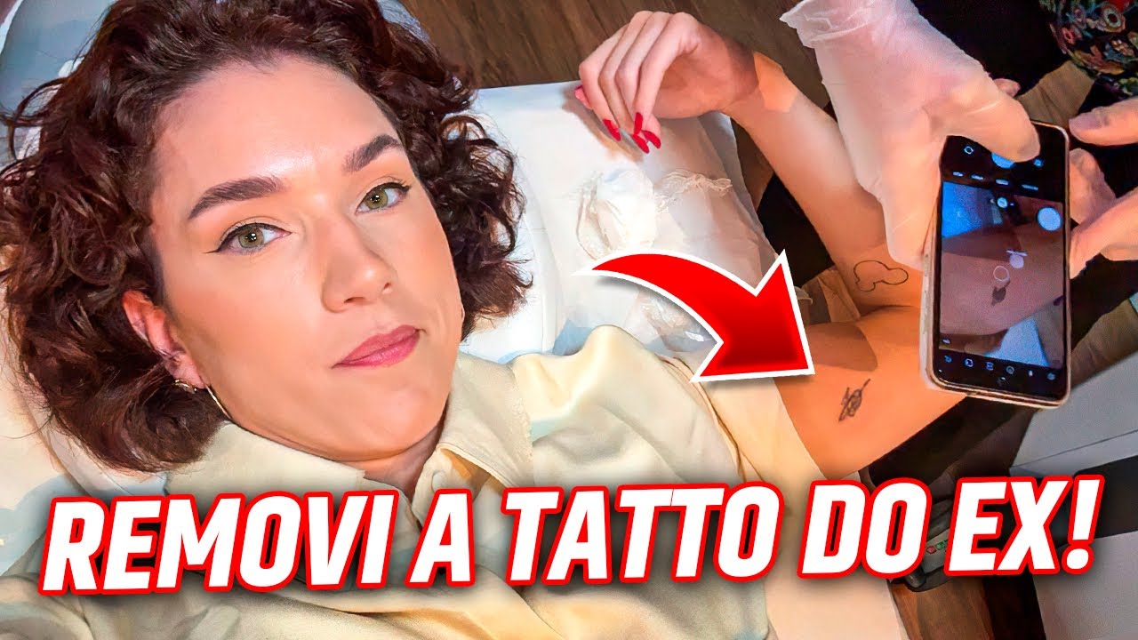 DECIDI REMOVER A TATUAGEM DO EX - PREÇO E DOR!