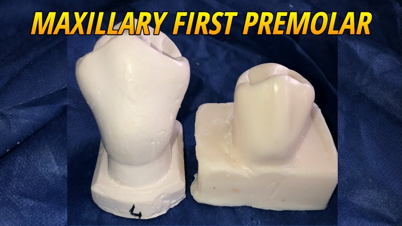 Carving of Maxillary First Premolar (Tooth Morphology)