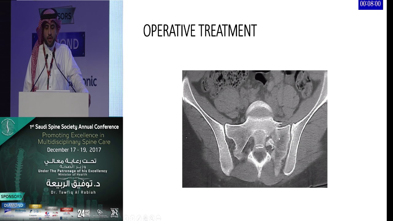 Lumbo-Sacro-Pelvic Fractures by Dr. Hani Alsulaimani