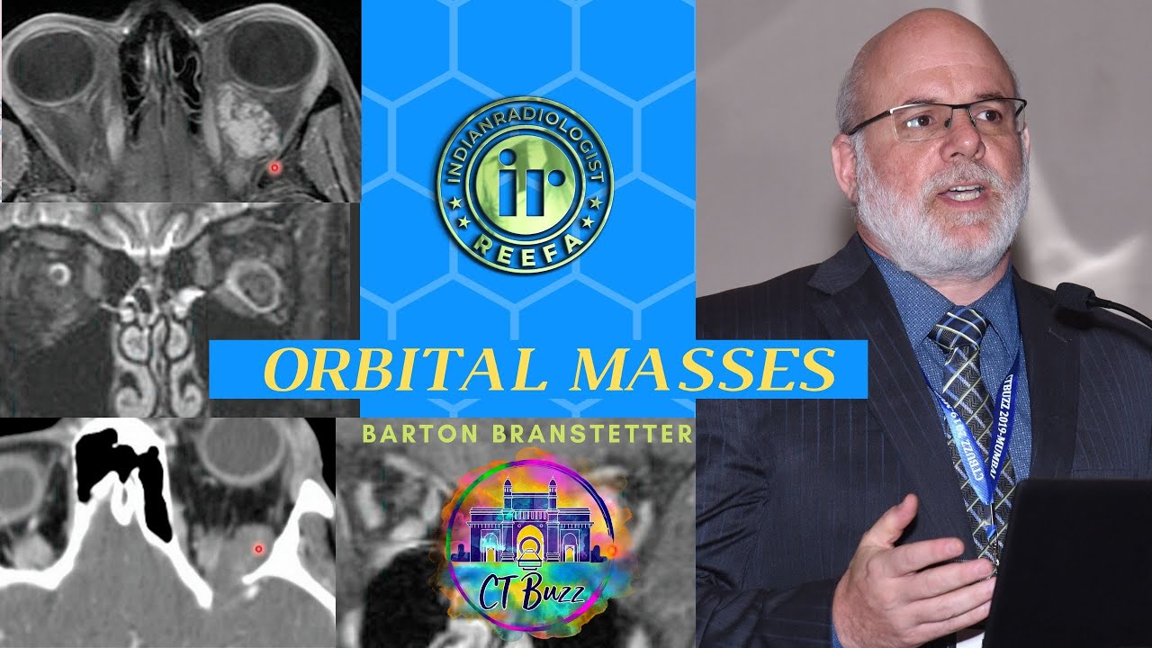 Orbital Masses Pattern Recognition by Dr Barton Branstetter