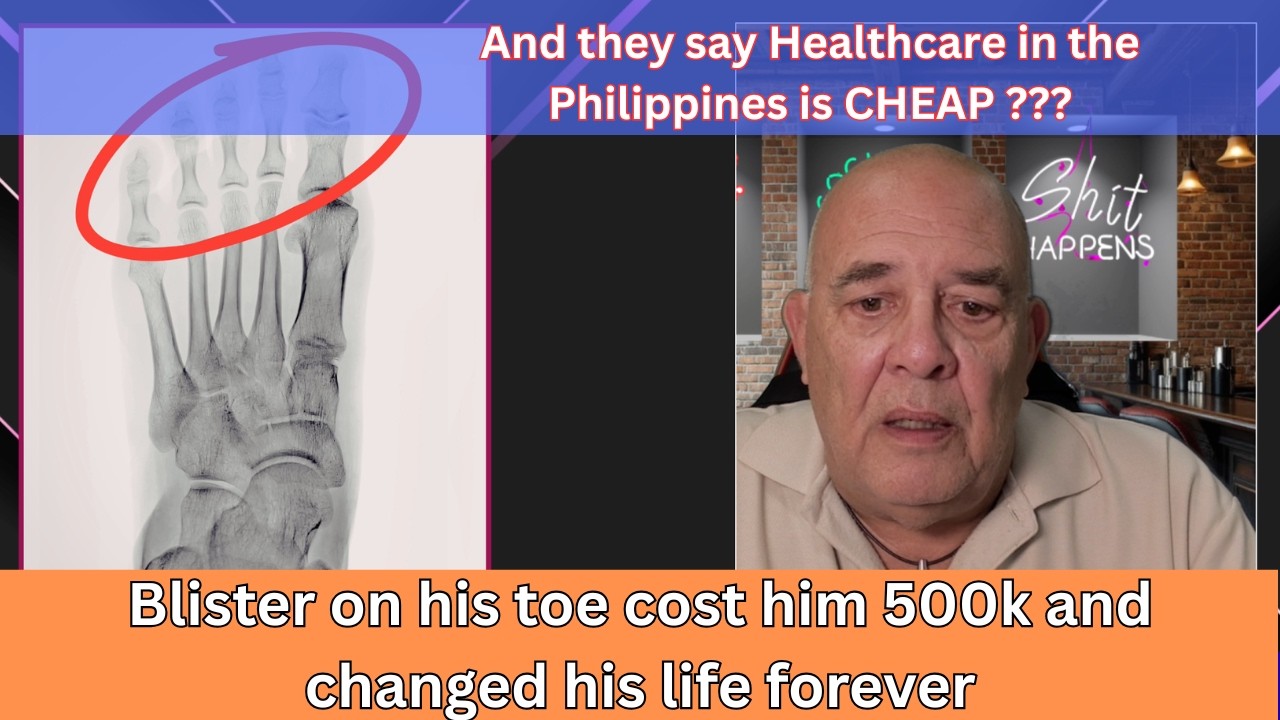 Expat's Medical Nightmare in Philippines Costs Nearly Half a Million and his leg