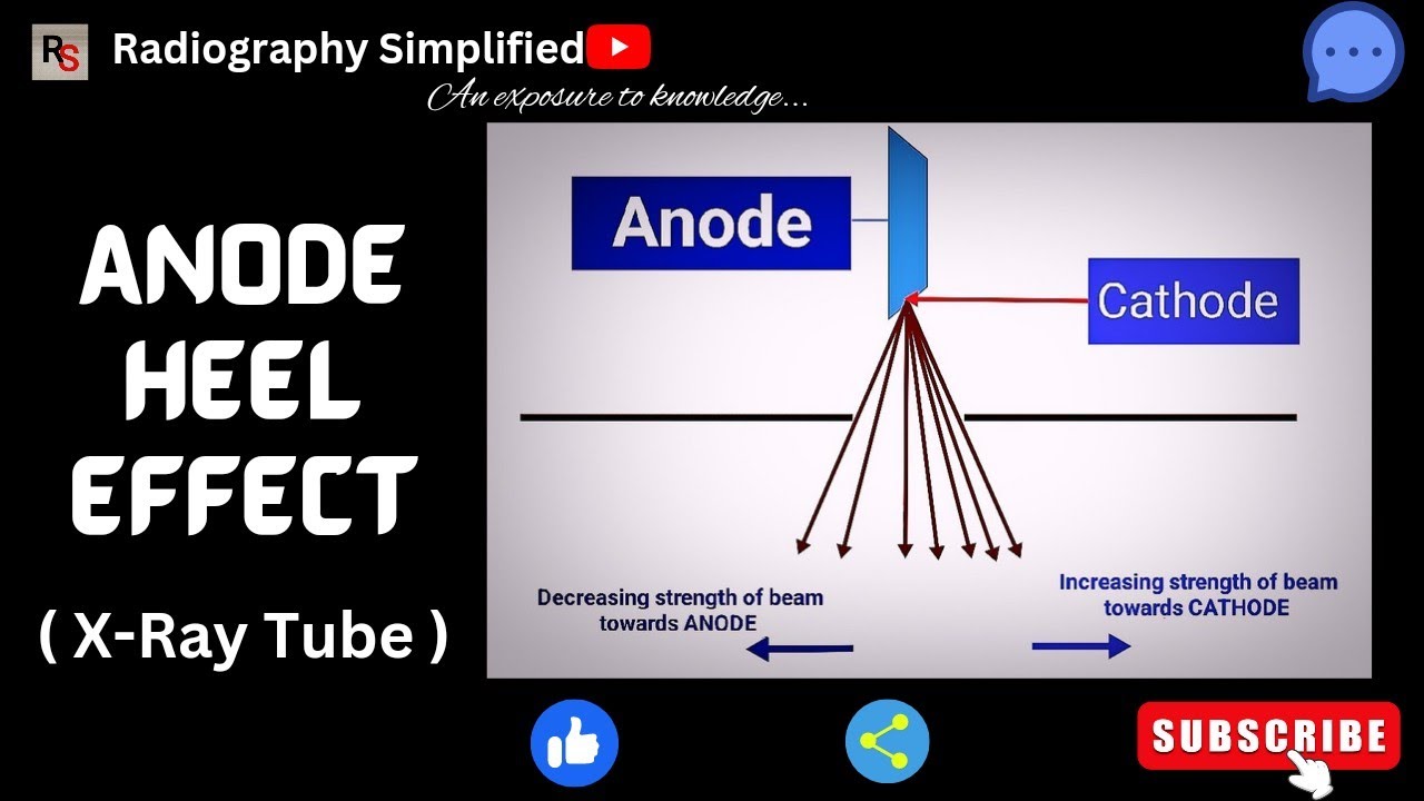 Anode heel effect ( x- ray tube) l Radiography simplified l