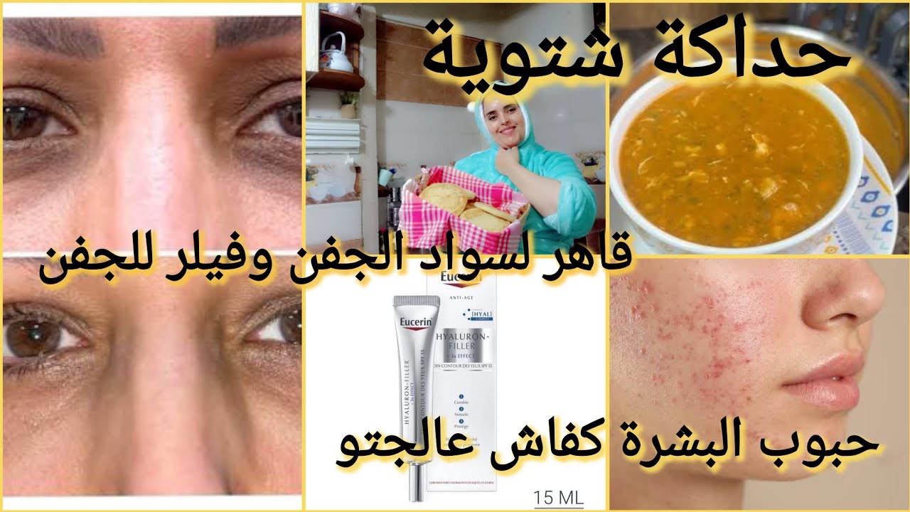 نفخ الخدود  وطريقتو كريم لازالة سواد تحت العين💞 هدا هو الحال نفس الحارة🤔 ملويات  افضل مرطب عندي  