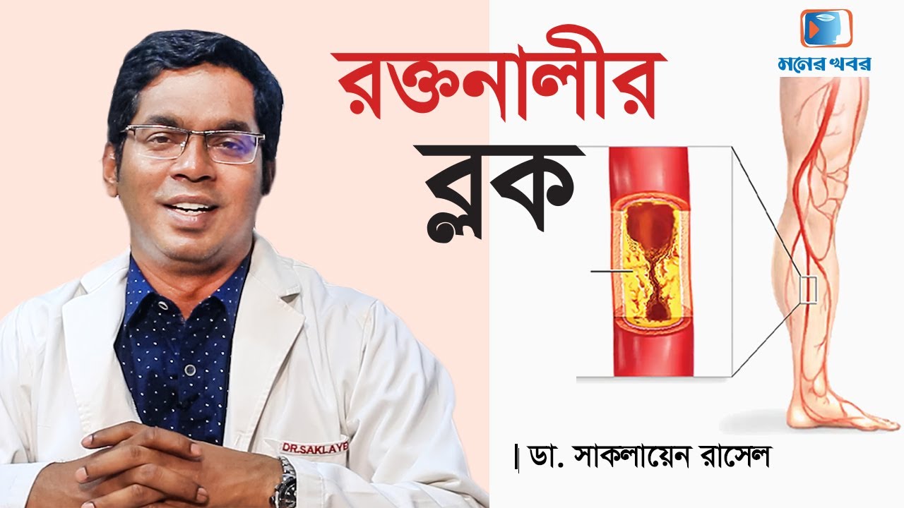 রক্তনালীর ব্লক প্রতিরোধে করণীয় কি? - Dr. Saklayen Russel