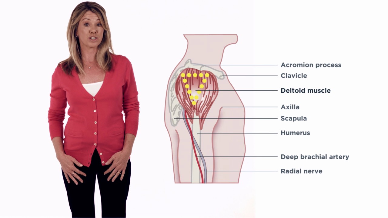 Invega Sustenna - How to Video