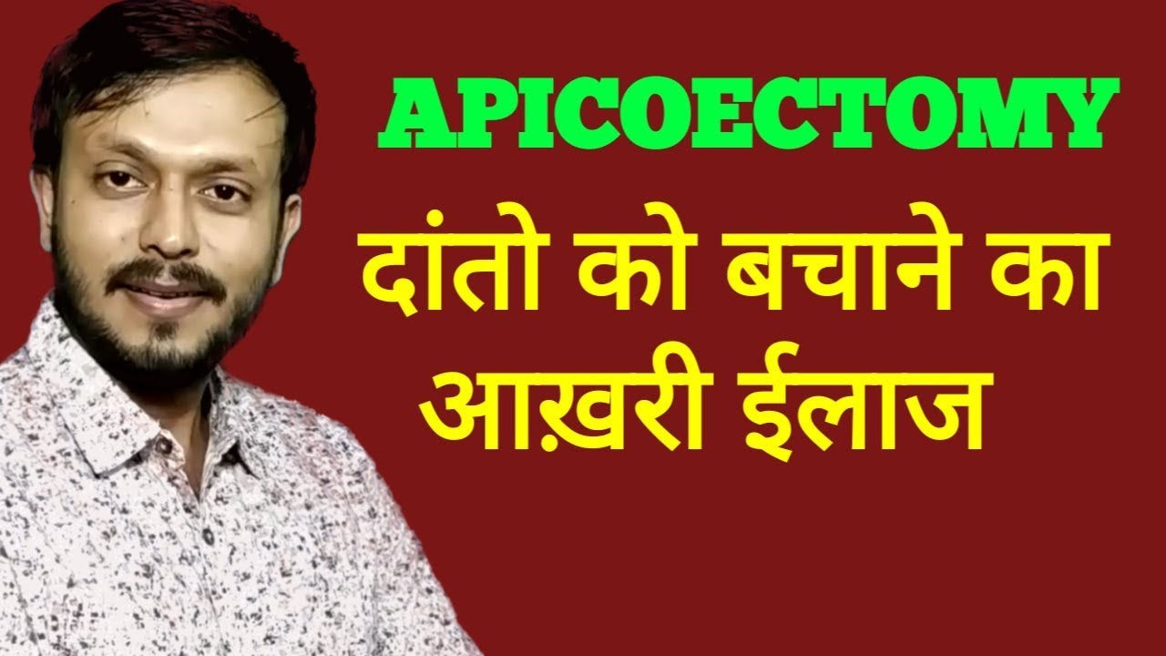 APICOECTOMY IN HINDI