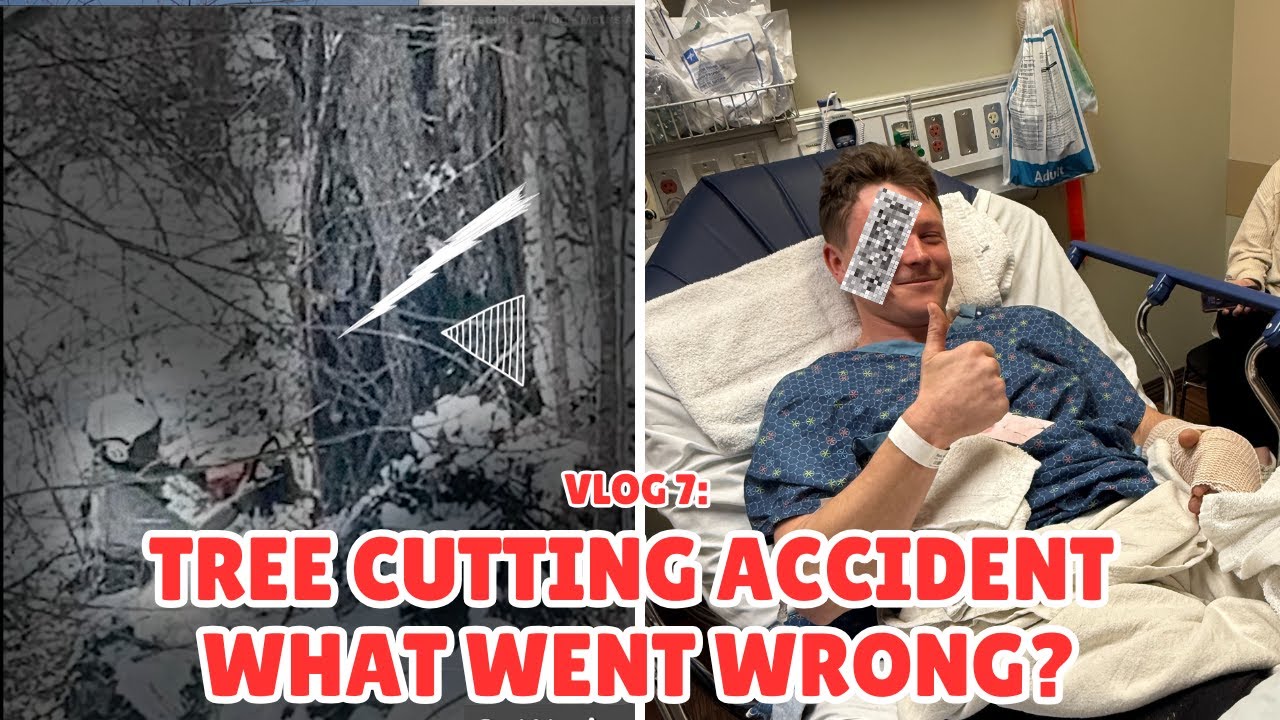 Vlog 7: Tree Cutting Accident &ndash; What Went Wrong?