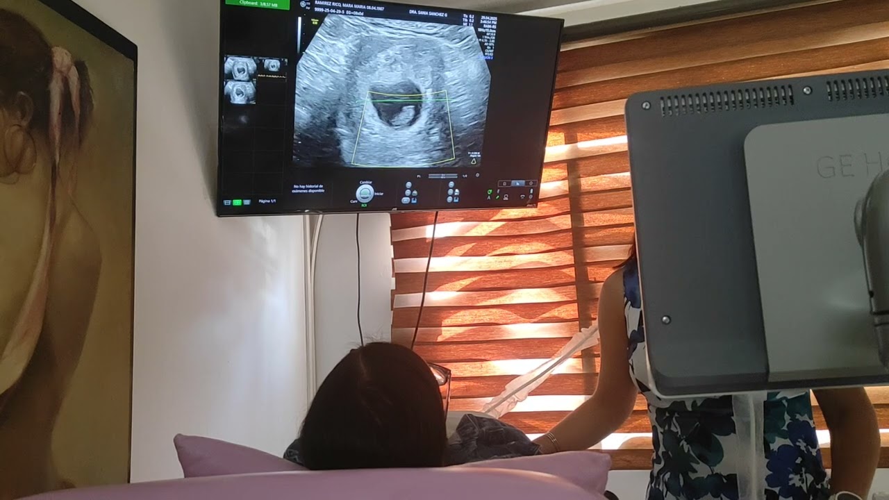Ultrasonido Mara 29-4-25