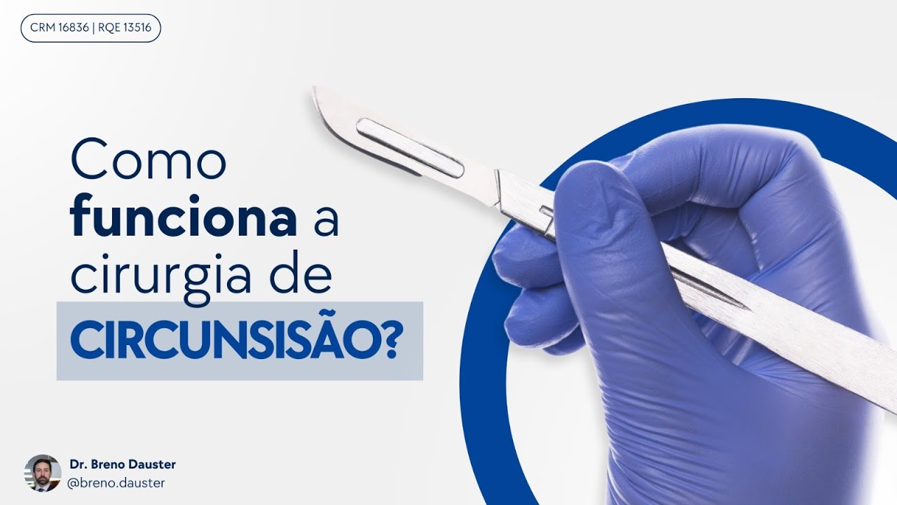 Como funciona a cirurgia de circuncis&atilde;o?