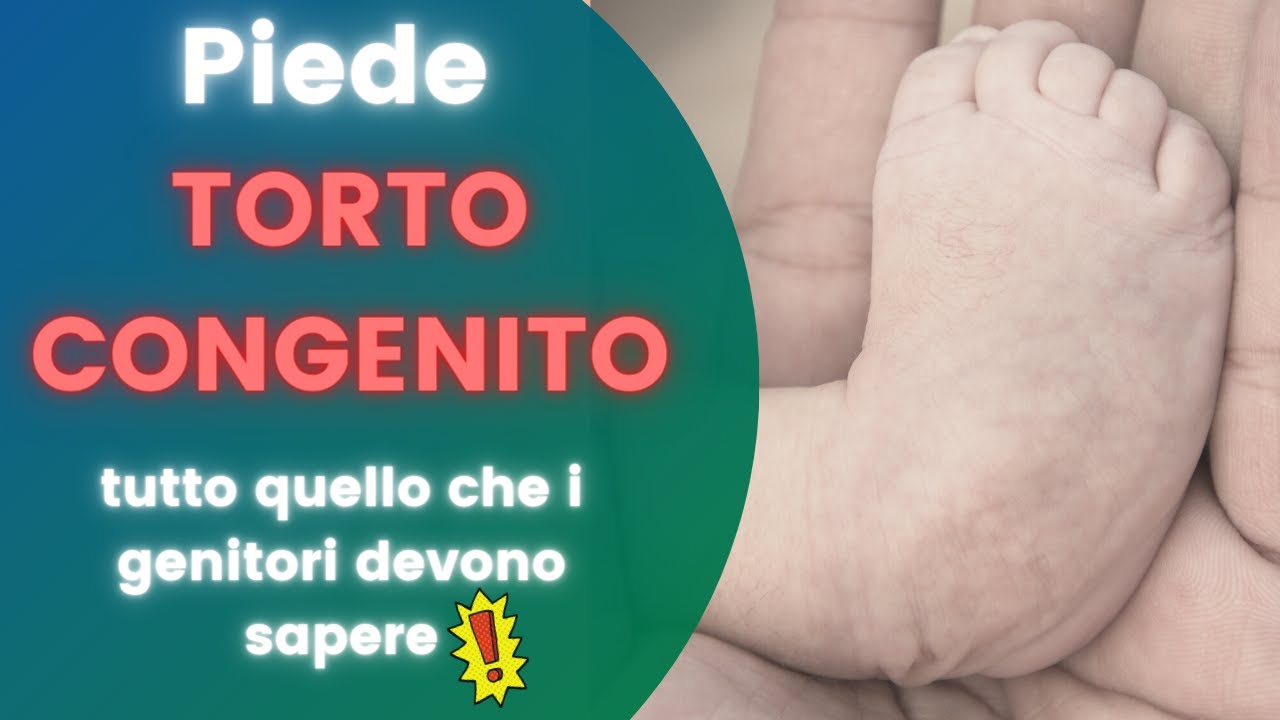Piede torto congenito - Tutto quello che voi genitori dovete sapere