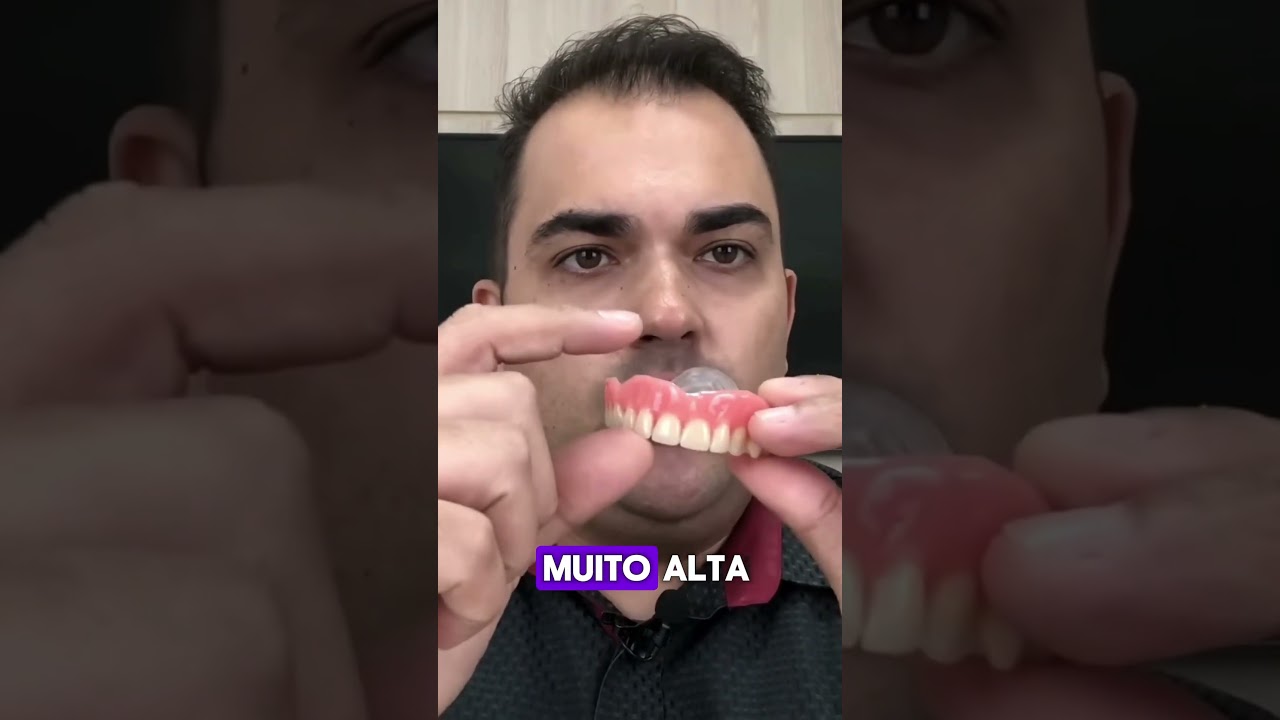 PR&Oacute;TESE FROUXA, FOLGADA OU CAINDO? O QUE PODE SER? DENTISTA EXPLICA