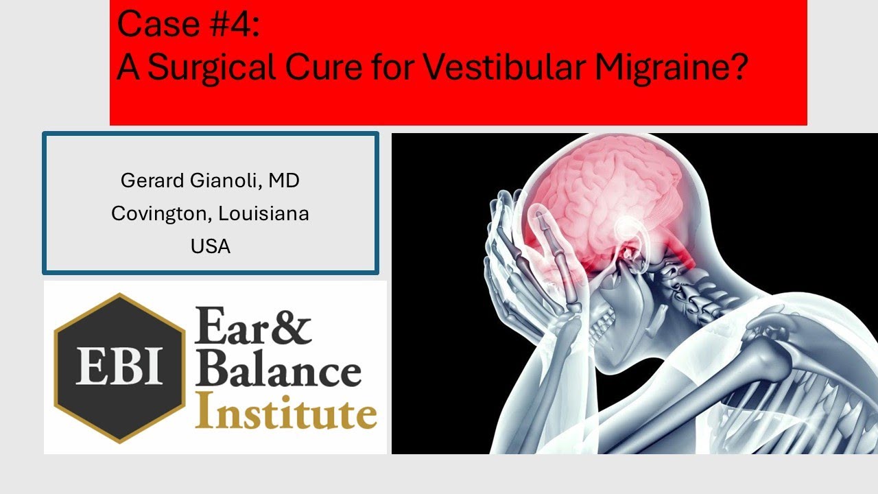Case 4   A surgical cure for vestibular migraine    1752252017479