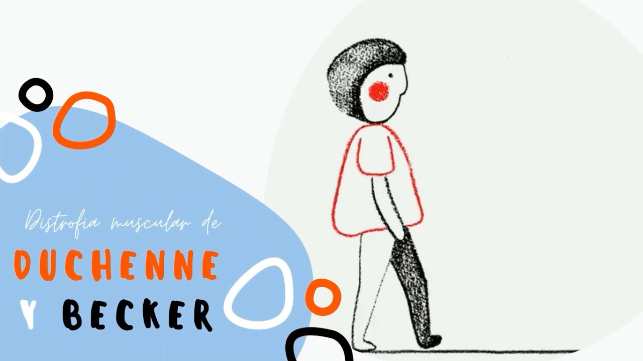 Distrofia muscular de Duchenne y Becker