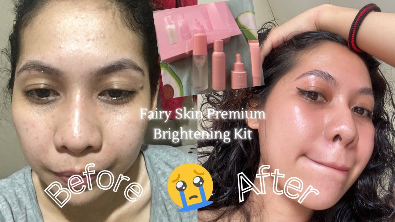 Fairy Skin Premium Brightening Kit (maiiyak ka nalang)🥹💔