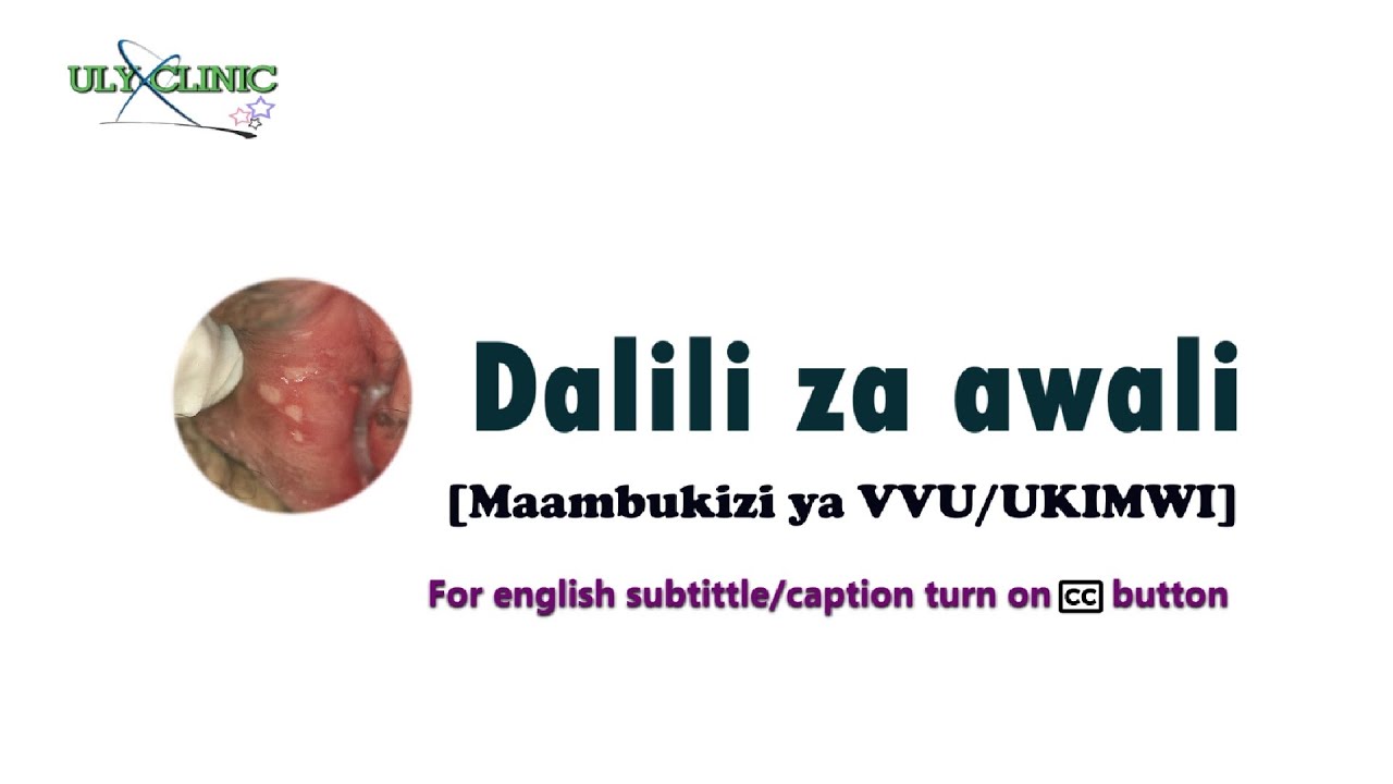 Dalili za awali za UKIMWI
