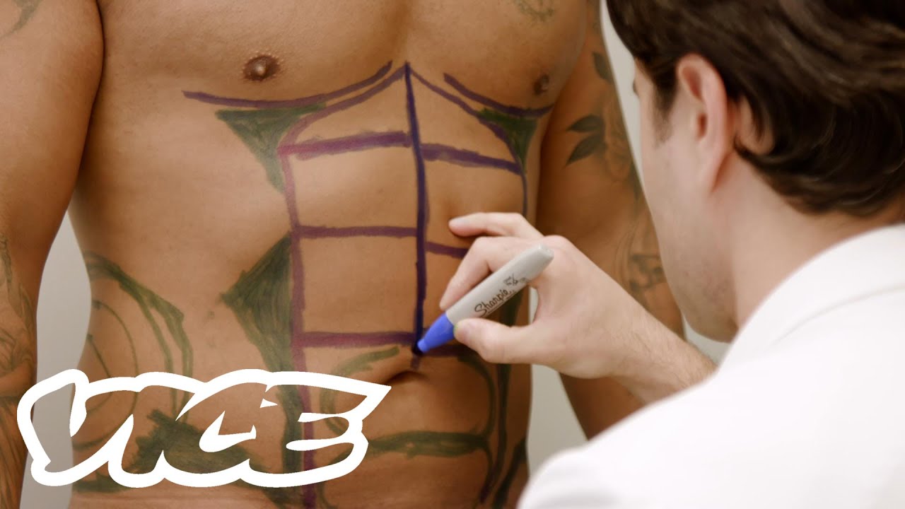 I Got Surgery to Have Six Pack Abs | The Rise of Male Plastic Surgery