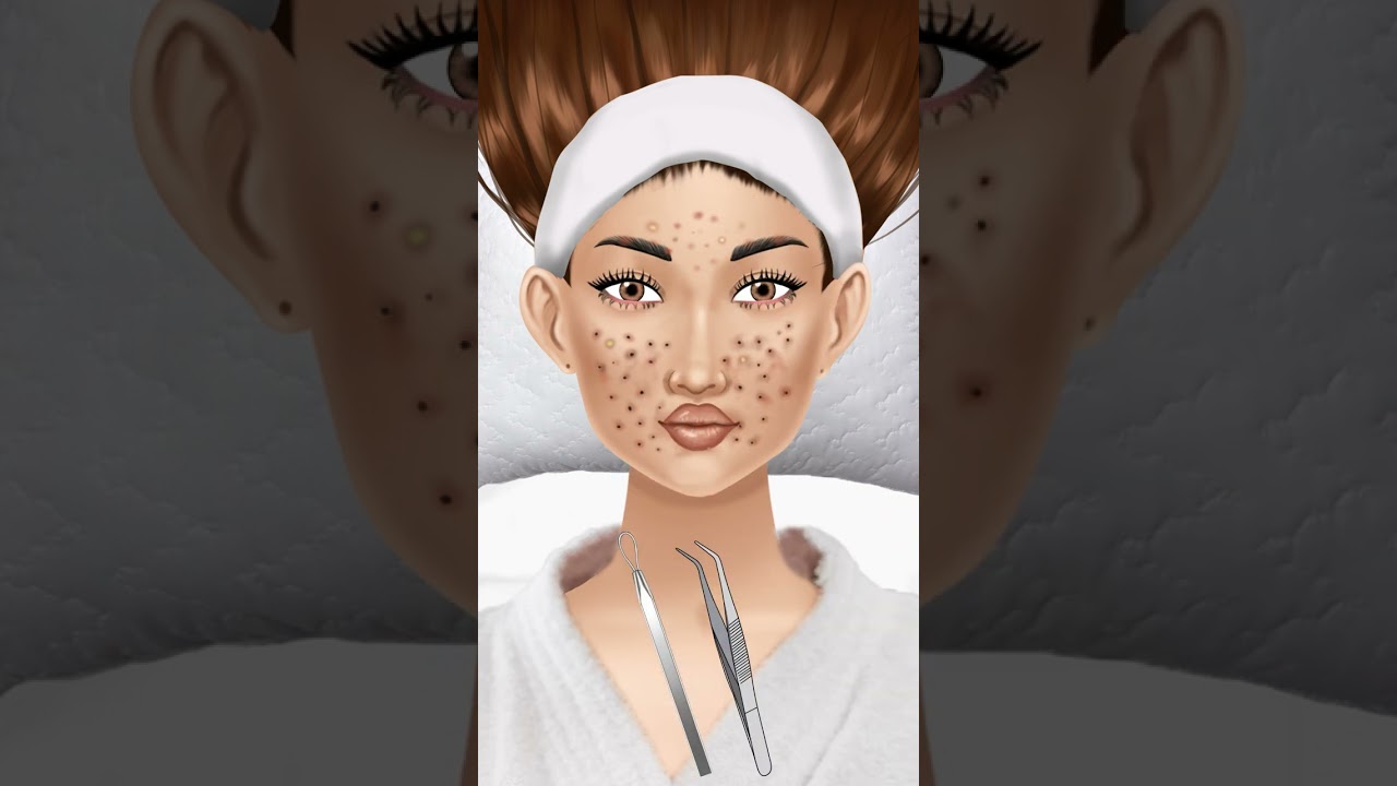 #asmr Giant Acne & Black Head Pimple Removal - Acne Deep Cleaning #animation #beauty