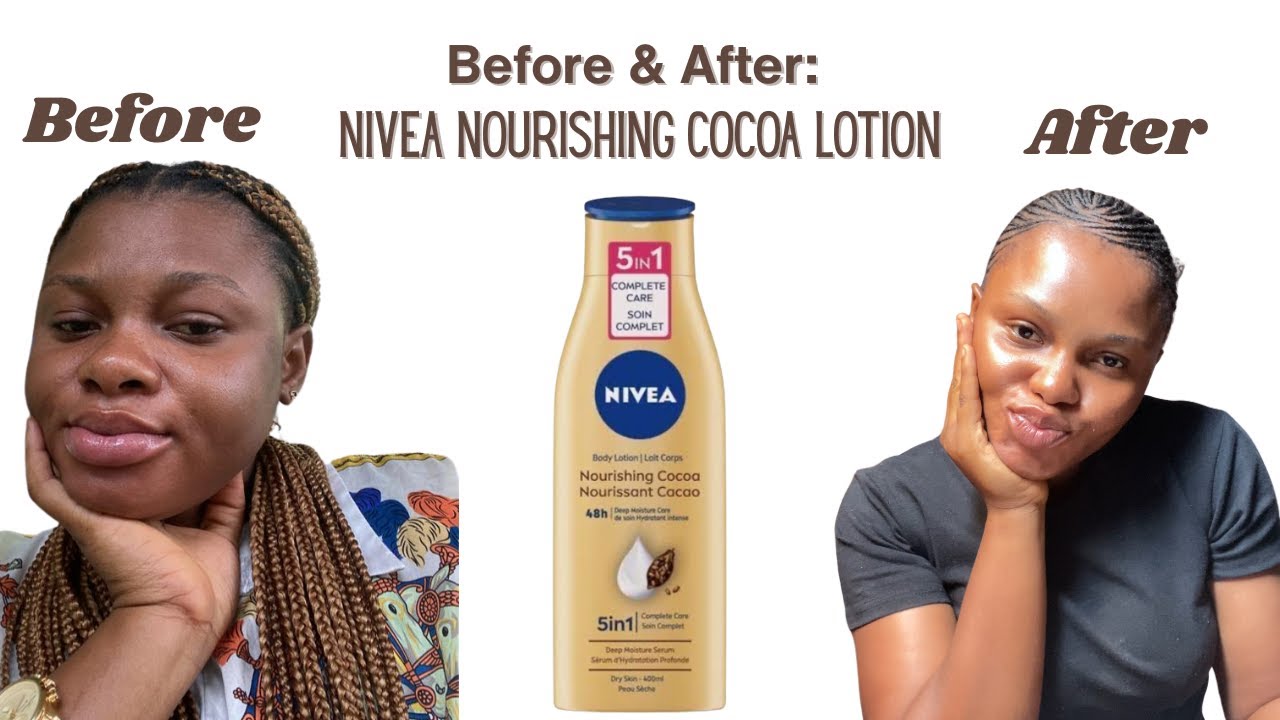 This Cleared My Postpartum Skin! | Nivea Nourishing Cocoa Body Lotion Honest Review ‼️