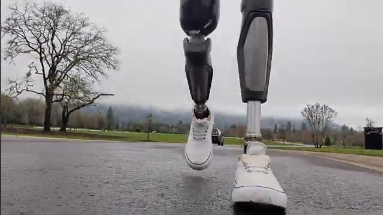 Double Above Knee Amputee Talks About Walking as a Form of Exercise
