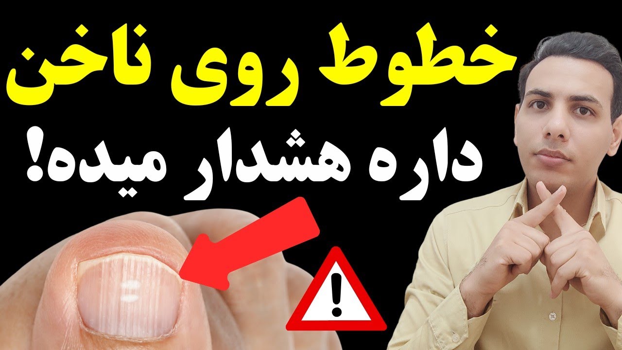هشدار برای کسانی که خطوط عمودی روی ناخن دارند| علت و درمان خطوط ناخن