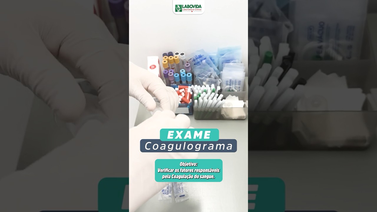 😱 Este exame coagulograma pode salvar sua vida! | COAGULOGRAMA #laboratorio