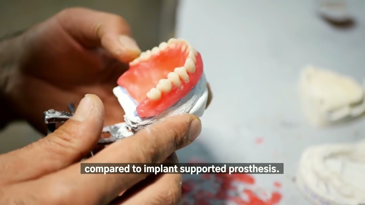 Dental Implants vs. Dentures: Which Option Is Right for You?
