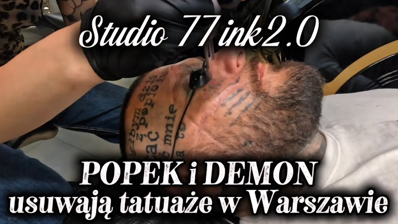 POPEK i ARCZI | usuwają  niechciane tatuaże laserem | to nic przyjemnego