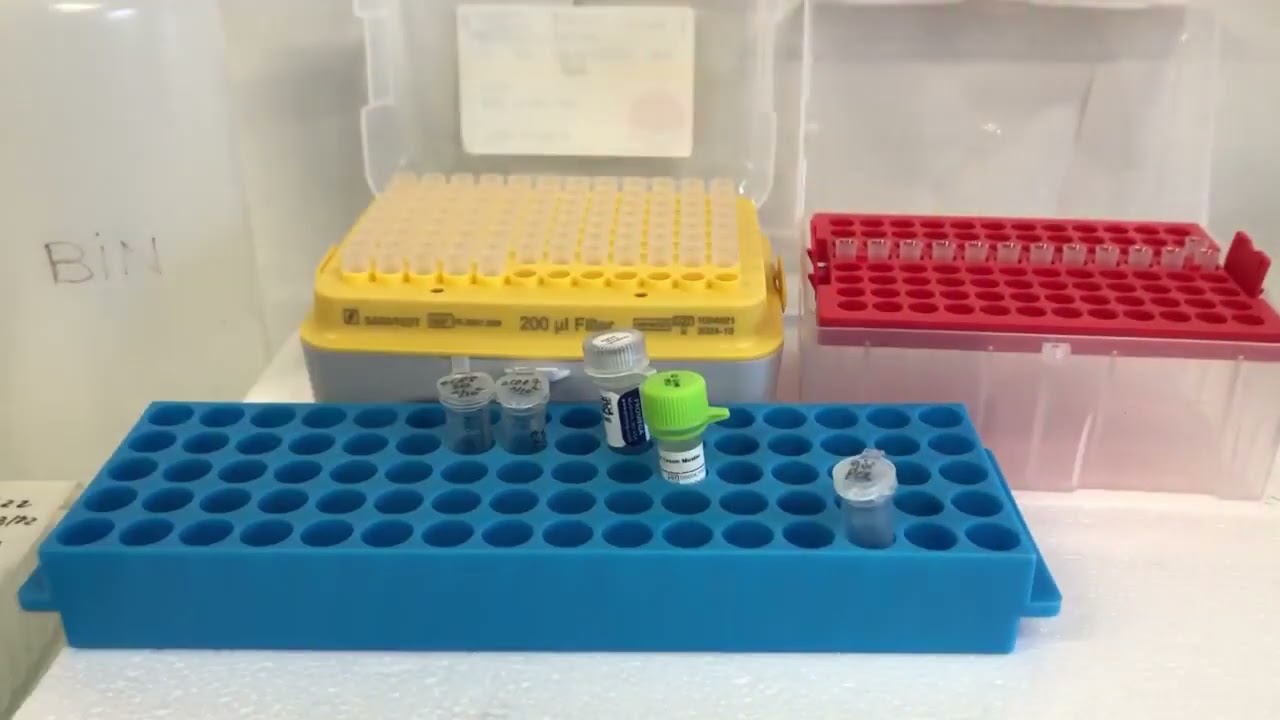 Étape 7 Clonage par PCR : Comment réaliser une PCR sur colonies