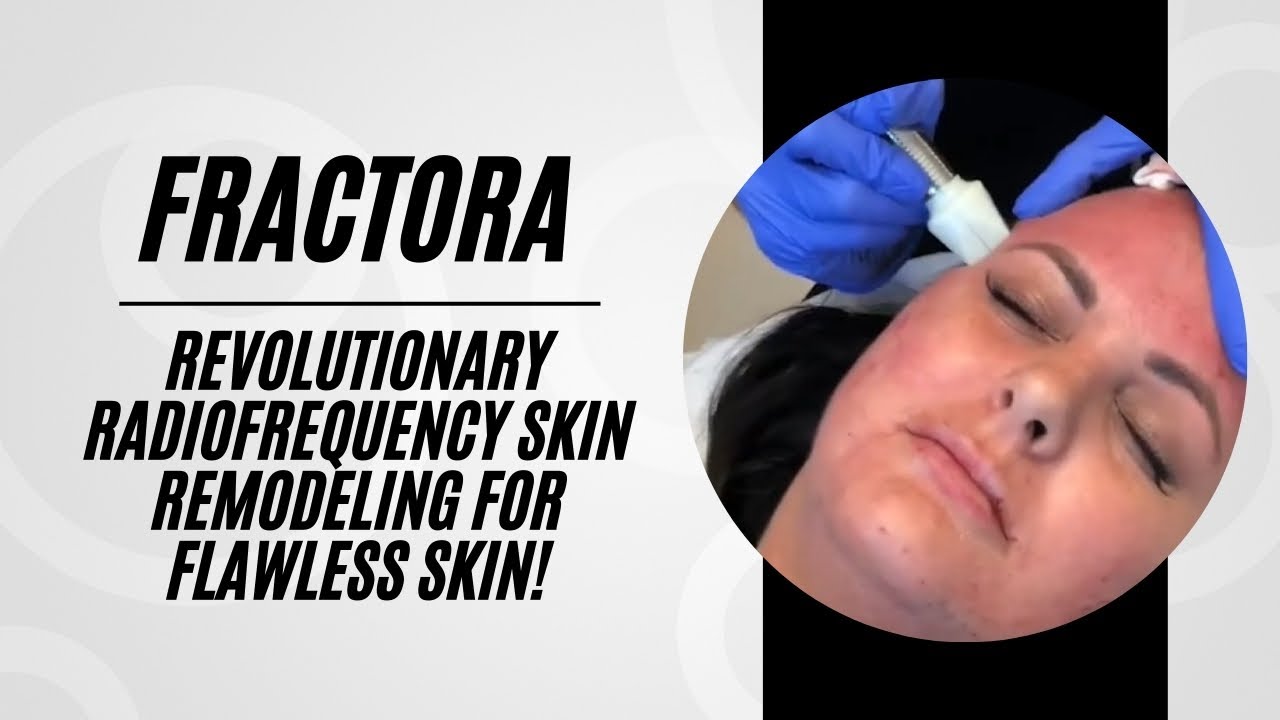 Fractora | Radiofrequency Fractional Skin Remodeling | Jason Emer MD