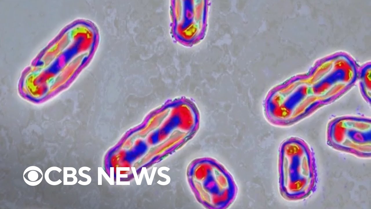 What to know about plague, according to medical experts