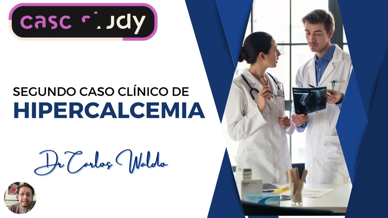 HIPERCALCEMIA  SEGUNDO CASO CLINICO