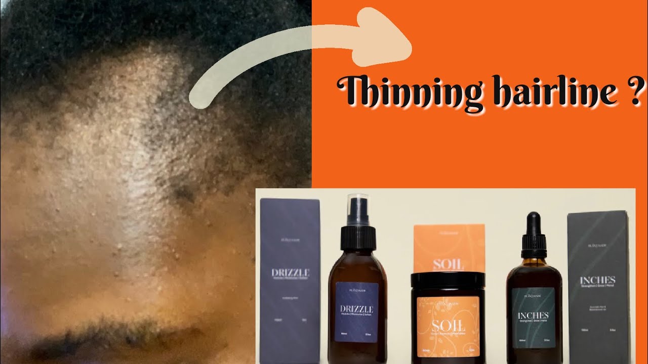 PLANTMADE HAIR PRODUCTS REVIEW 2023| How to regrow BALD SPOTS|Plantmade INCHES oil|Derma rolling