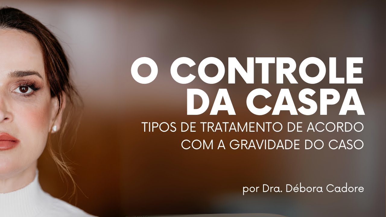 Qual o melhor tipo de de tratamento para caspa? | Dra. Débora Cadore