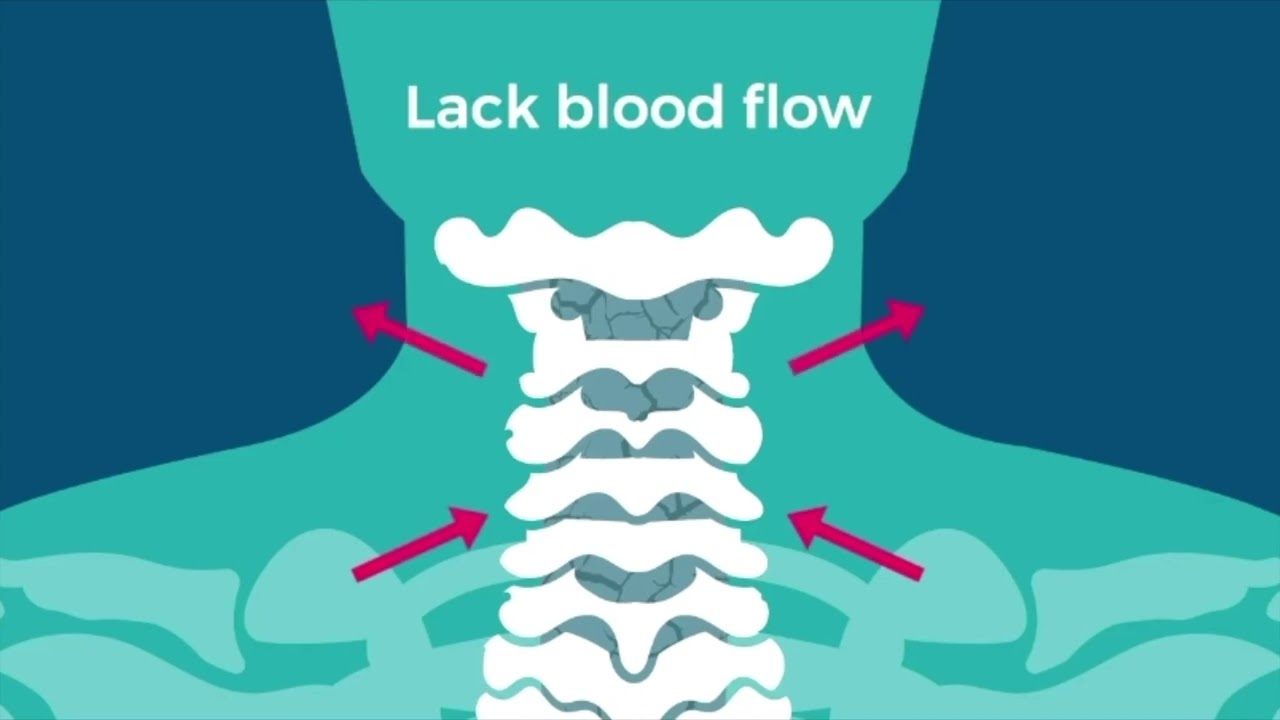 Spinal Corrective Home Exercises