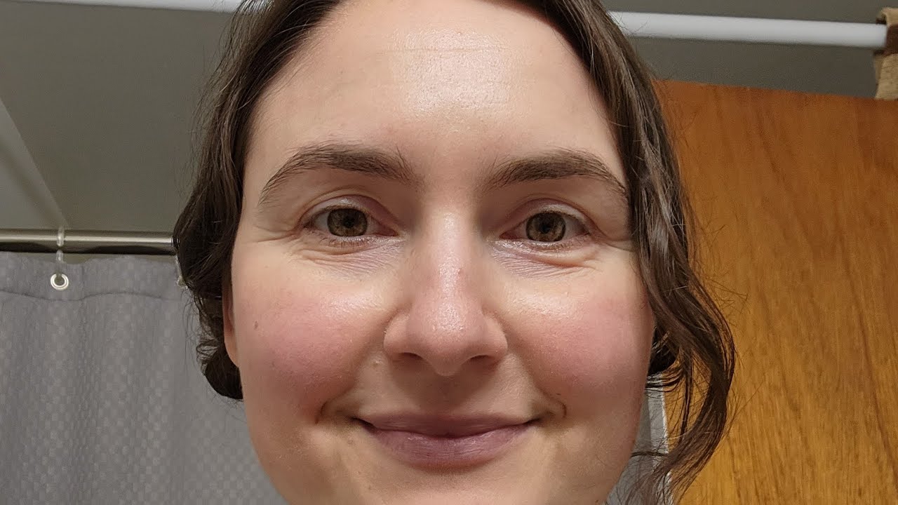 Updated 2023 cleansers for rosacea: hits and misses