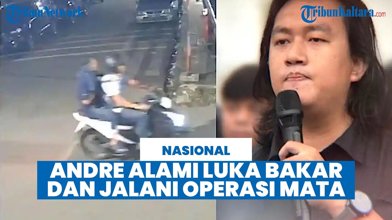 Update Kondisi Andrie Yunus Usai Penyerangan Air Keras: Alami Luka Bakar dan Operasi Mata