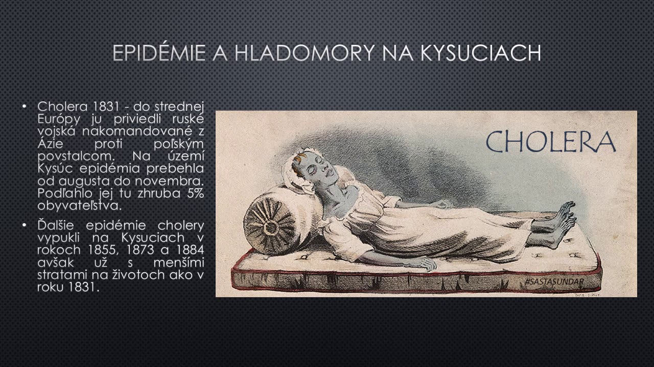 Historické zaujímavostí Kysúc