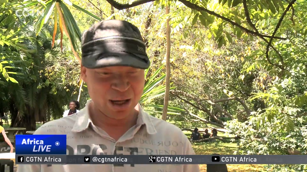 Living with Albinism: 70,000 people living with the condition in Zimbabwe seek support