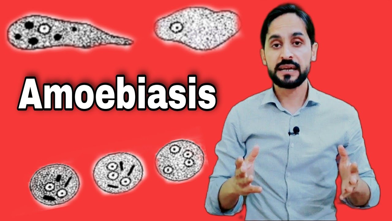 Amoebiasis Infection | Entamoeba Histolytica | Lab Diagnosis and Treatment