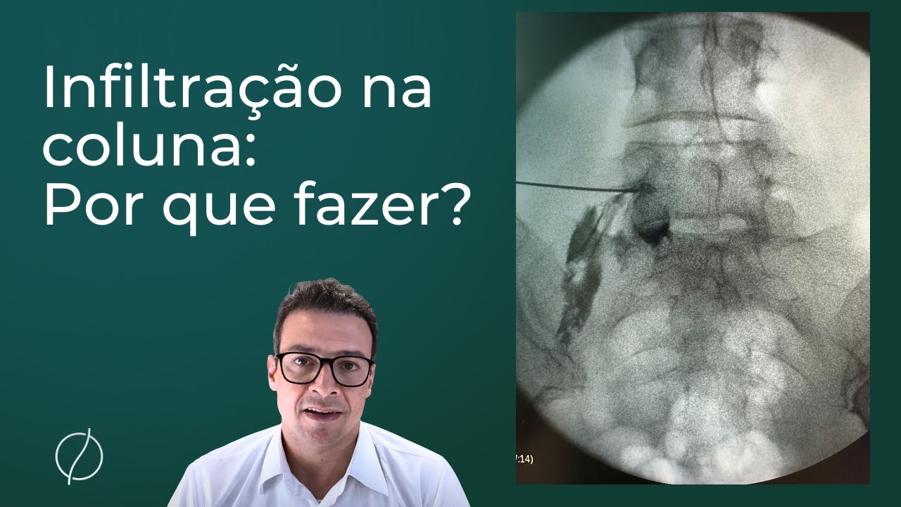 Infiltração na coluna: por que fazer?